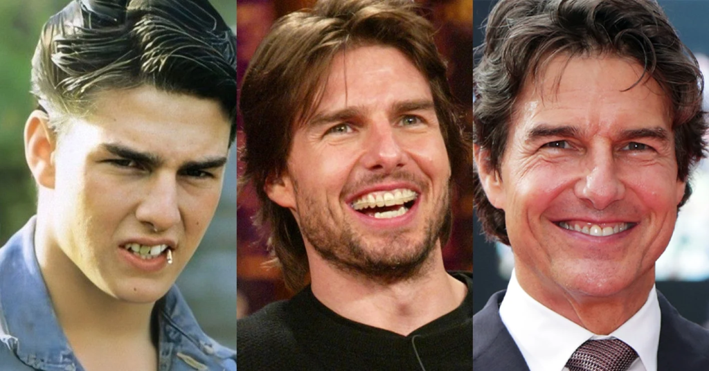  Dazzling white teeth of Tom Cruise, adding to his magnetic on-screen presence.