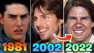 Tom Cruise's iconic Hollywood smile, a symbol of dental perfection.